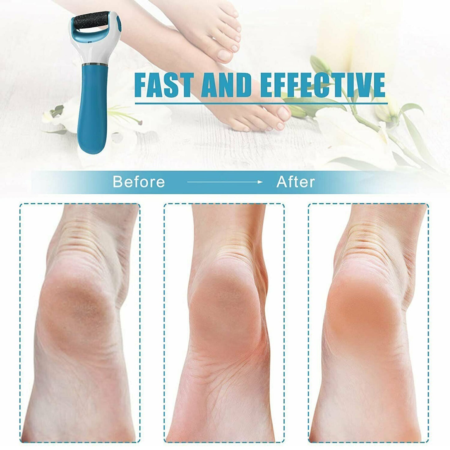 Electronic Dry Foot File Callous Remover For Feet Electric Foot With Roller Hard And Dead Skin- Regular Coarse Baby Smooth Feet In Minutes. For In Home Pedicure Foot Care Battery Powered Usb (Battery Not Included)